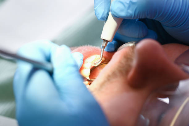 Best Cracked Tooth Emergency Dentist  in Port Hadlock Irondale, WA